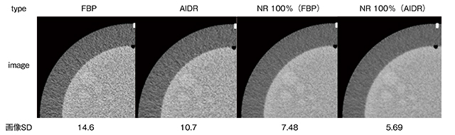 図1　各画像におけるファントム画像と画像SD値