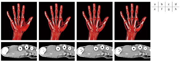 図2　エネルギーの違いによる画像の比較 120kV相当MIXデータ：VR画像（a），アキシャル画像（e） 140kV：VR画像（b），アキシャル画像（f） 190keV（第一世代仮想単色X線画像）：VR画像（c），アキシャル画像（g） 190keV（第二世代仮想単色X線画像）：VR画像（d），アキシャル画像（h） VR画像は比較しやすいよう，未処理状態の画像である。屈筋腱の描出に違いは少ないが，筋肉組織のノイズはdが最も少ない。