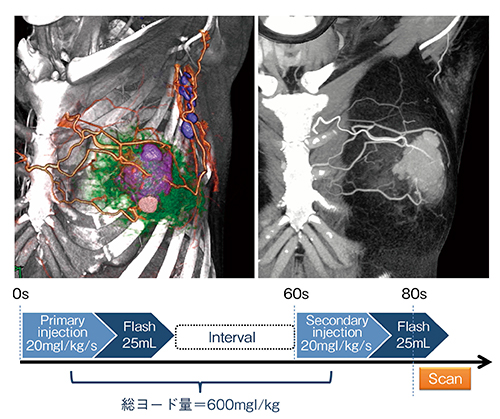 図1　乳がんにおける手術支援画像およびDSIを用いた造影プロトコール