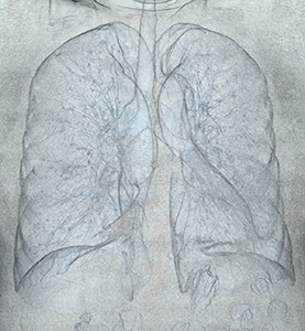図2　肺透過カラーマップ