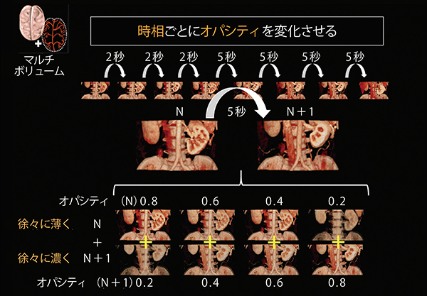 図4　低線量4D-CTにおける間欠時間の影響への対策（In-between animationの応用）
