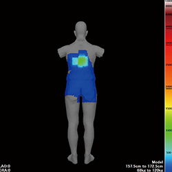 DTS（Dose Tracking System）：手技中の患者皮膚入射線量をリアルタイムに可視化して局所線量の把握が可能