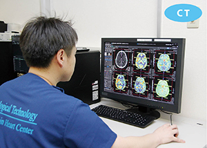 医用画像ワークステーション「Vitrea」を急性期脳卒中診療に活用