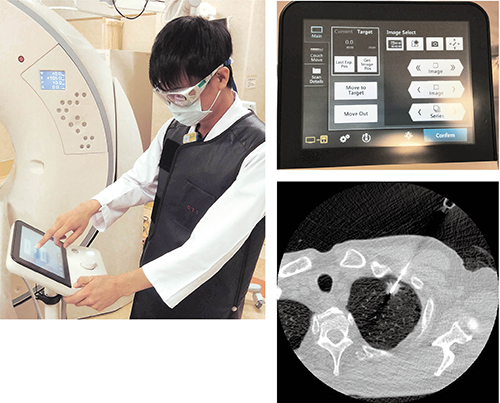 検査室内でCT操作が可能な新CT透視システム（左）、タッチパネル画面（右上）、“Real time AIDR 3D”によるノイズ・ストリークアーチファクト低減処理で視認性が向上（右下）