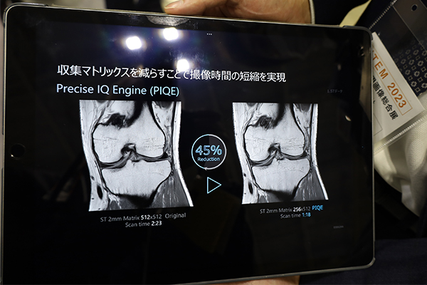 PIQEでは収集マトリクスを減らすことで撮像時間の短縮も可能