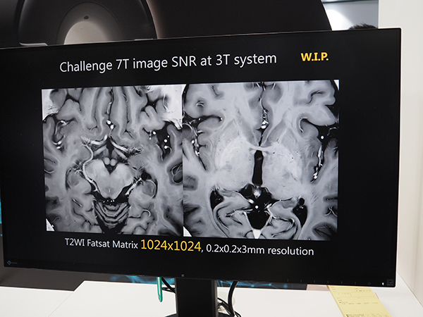1024×1024マトリクス，0.2×0.2×3mmの7T MRIに匹敵する超高精細画像（W.I.P.）