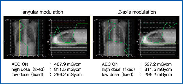 図4　人体ファントムを用いたDL-Spectral CTにおけるAECの検証