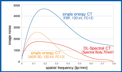 図6　DL-Spectral CTにおけるNPSの検討
