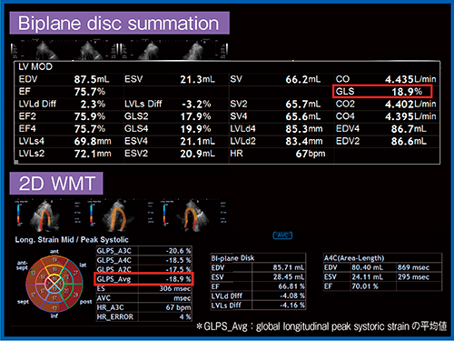 図5　Biplane disk summation法と2D WMTによるGLSの比較