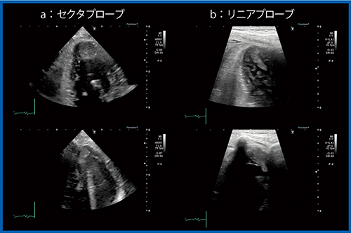 図9　症例3：セクタおよびリニアプローブによる心尖部の血栓の描出（CTRCD症例）