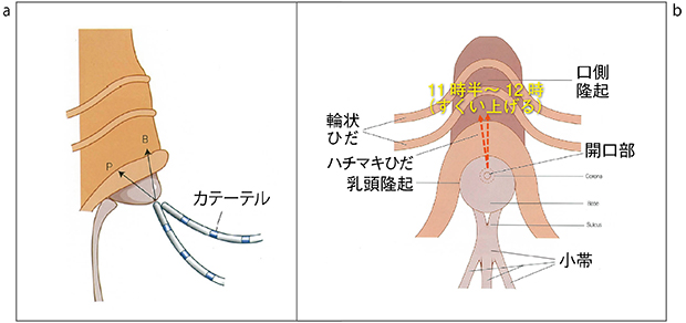 図3　胆管挿管の角度（a）と方向（b） （参考文献1）より転載）