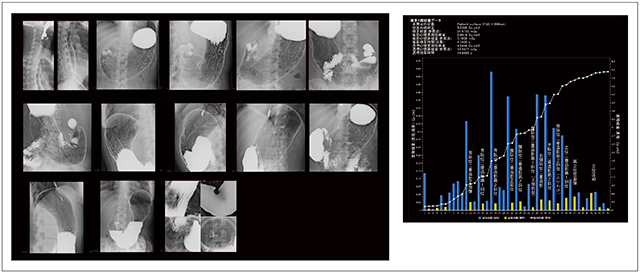 図7　ベテラン技師による基準撮影法2と任意撮影の画像（左）とX線照射線量レポート（右）