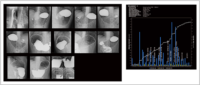 図8　新人技師による基準撮影法2と任意撮影の画像（左）とX線照射線量レポート（右）