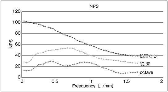 図6　透視像におけるoctaveと従来技術とのNPSの比較