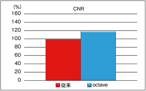 図8　撮影像におけるoctaveと従来技術との濃度分解能の比較