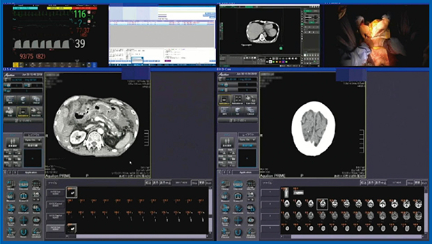 図3　症例1：肝損傷・急性硬膜下血腫（55歳，男性） ハイブリッドER内の天吊りの大画面モニタにて，すべての画像をリアルタイムに確認可能