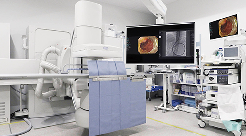 図1　高知赤十字病院のCアーム型X線TVシステム「Ultimax-i」 高画質・低線量検査コンセプト“octave”搭載モデル