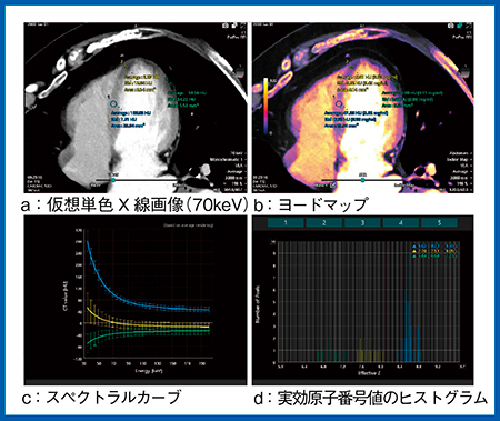図6　症例3：心臓CT（W.I.P.）（画像提供：華岡青洲記念病院・山口隆義氏）