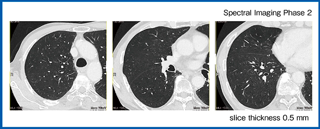 図7　症例4：胸部CT（肺野）（W.I.P.）