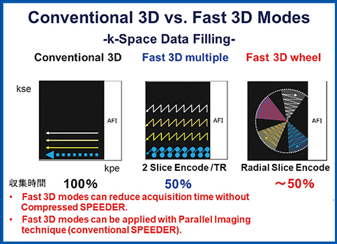 図2　従来の3D収集とFast 3D modeであるFast 3D multipleとFast 3D wheelのk-spaceデータ収集法の比較