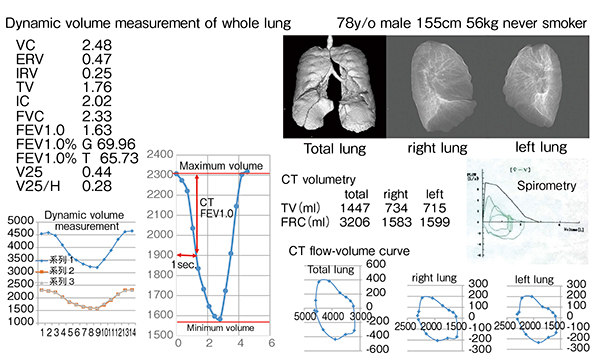 図9　健常例全肺のダイナミックボリューム測定（78歳、男性）