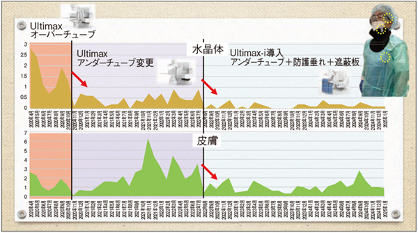 図2　当院の外部被ばく線量測定 Ultimax-i（アンダーチューブ型）と防護垂れ、遮蔽板の導入により、水晶体、皮膚ともに被ばく線量が低減した。