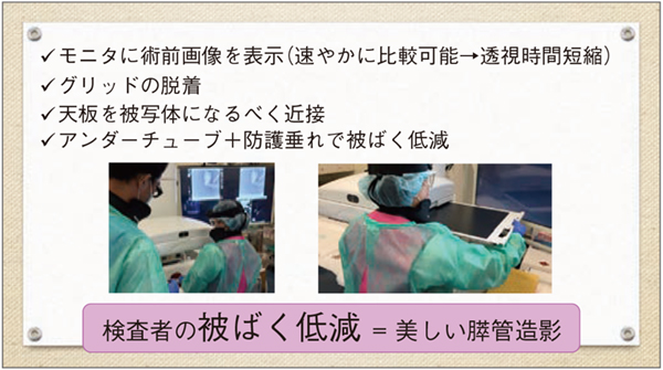 図4　標本膵管造影検査のコツ