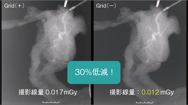 図5　標本造影検査におけるグリッドの影響