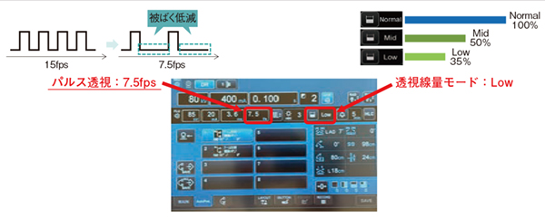 図2　帝京大学での線量率とパルスレート 9画像処理技術群（octave SP＋Accent）により間接的に線量とパルスレートを抑えて、かつ確実性を担保する。