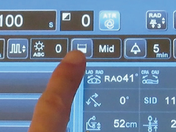 図10　検査に応じた透視線量モードの切替はワンタッチ