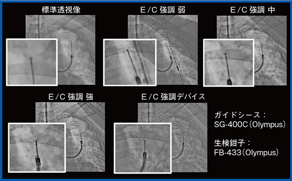 図1　Accentモード適用による視認性の向上（経気管支生検：TBLB） 強調を変えることで鉗子の視認性が向上している。