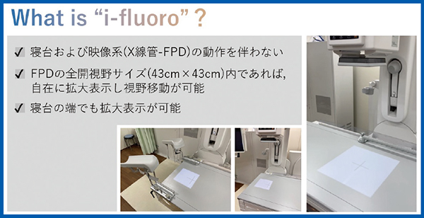 図2　i-fluoroの特長