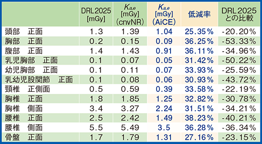 図2　各部位におけるAiCE導入前後の被ばく線量の比較