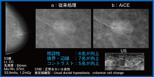 図6　症例3：腫瘤の評価