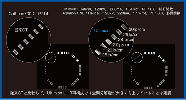 図2　UltimionのXY面内の解像度特性