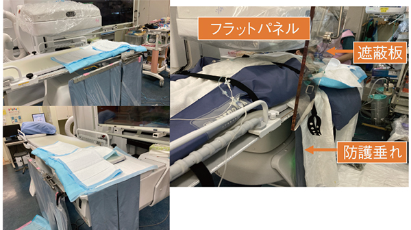 図1　当大学のERCPの様子