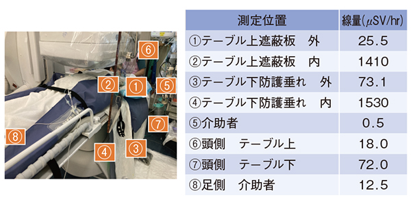 図4　当大学のERCP施行時の線量測定結果