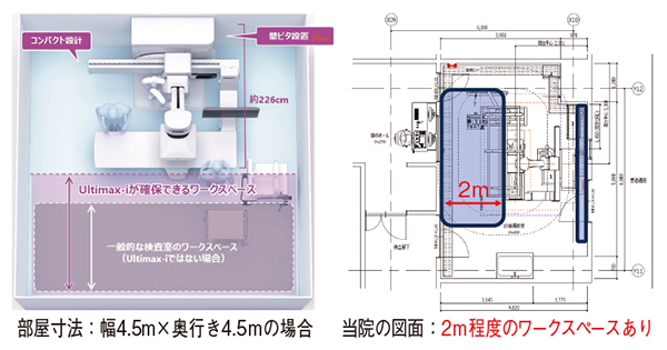図2　Ultimax-iの設置性