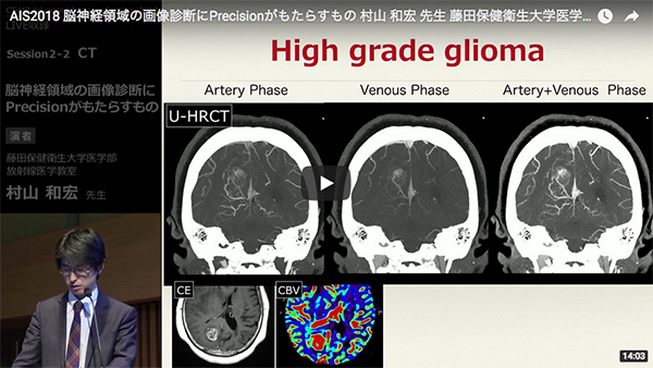脳神経領域の画像診断にAquilion Precisionがもたらすもの 村山　和宏（藤田保健衛生大学医学部 放射線医学教室