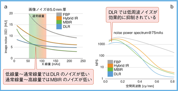 図2　DLRにおける画像のノイズ特性 a：SD　b：NPS