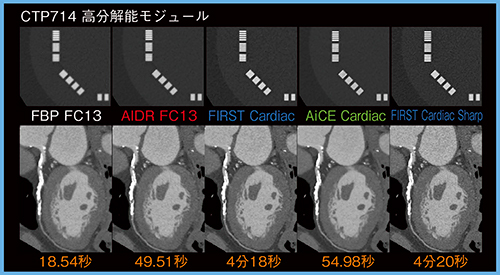 図6　冠動脈CT（高コントラスト領域） （撮影条件：Volume scan，0.275s/rot，100kVp，CTDIvol 8.2mGy，DLP 131.6mGy・cm）