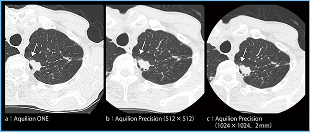 図1　症例1：肺腺癌