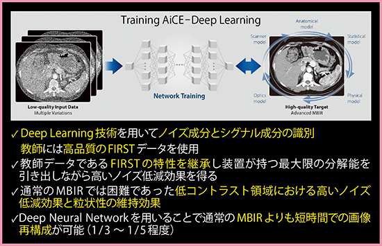 図1　AiCEの特徴 （画像提供：キヤノンメディカルシステムズ株式会社）