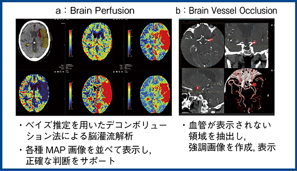 図2　Abierto RSS for Neuroの造影CT解析のアプリケーション