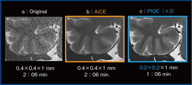 図4　PIQEによるコントラストの改善
