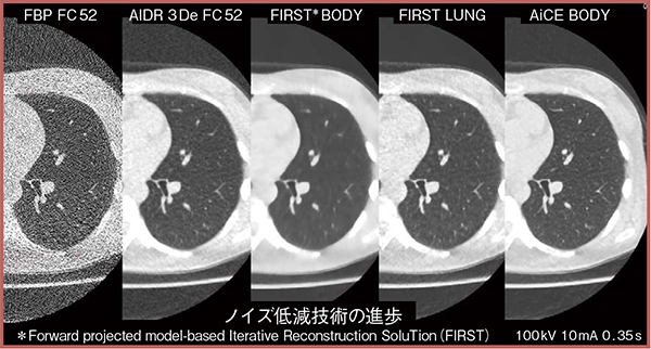 図4　ノイズ低減技術の進歩