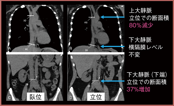 図4　立位撮影による上下大静脈の評価