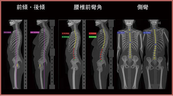 図6　独自開発した姿勢解析ソフトウエアによる姿勢の検討
