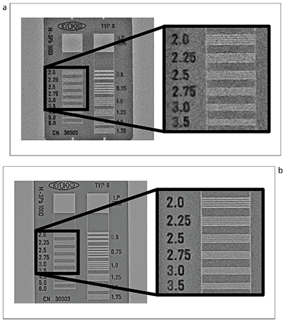 図2　X線チャートの透視画像比較 a：従来FPD b：超高精細検出器 超高精細検出器で得られた画像は，より細かなラインまで視認可能であり，高い空間分解能を有することがわかる。