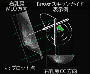 図2　Breastスキャンガイド 2本の線の交点（←）が病変の推定位置を表します。